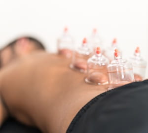 Mandlig klient modtager cupping på ryggen