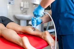 shockwave behandling på læg hos ultimate body coach